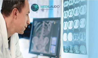 Os benefícios da Telerradiologia